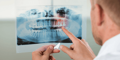 BlogPost 148750816013 Chirurgien-dentistes : des opportunités au delà des frontières